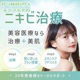 ルンソルテ(lunsoleto)