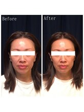 たくろう鍼灸院 豊田本院/Before＆After