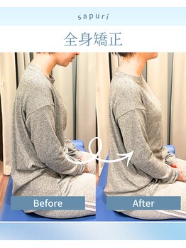 サプリ 梅田/姿勢矯正で気軽に美姿勢♪