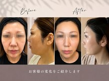 アイリー(IRIE)の雰囲気(たるみケアお肌の弾力、引き締めケアはアイリーにお任せ下さい♪)