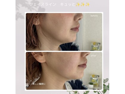 ルミナージュ 辻堂(Luminage)の写真