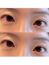 ユーロ(EURO)/ラッシュリフト／まつ毛パーマ