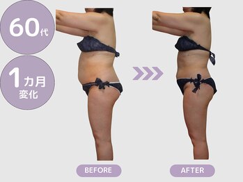 ビップ 赤坂店(Bipp!)/60代・1カ月の変化