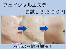 柏ベルミーランド/お悩み改善のお手伝いします！