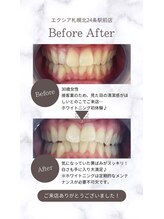 エクシアホワイト 平岸駅前店/