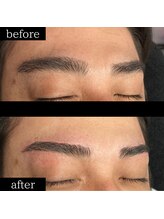 ユー 千葉駅前店(you)/症例写真