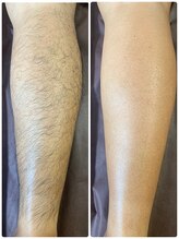 ハグ(Hug)/メンズ足下ワックス