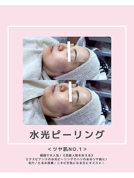 ソワナ(soina)/【神楽坂駅/フェイシャル/毛穴】