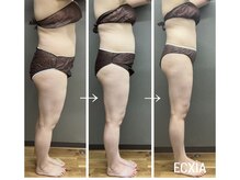 エクシア(ECXIA)/