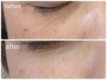 メイクマジック(Makemagic)/乾燥小ジワ改善