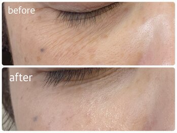 メイクマジック(Makemagic)/乾燥小ジワ改善