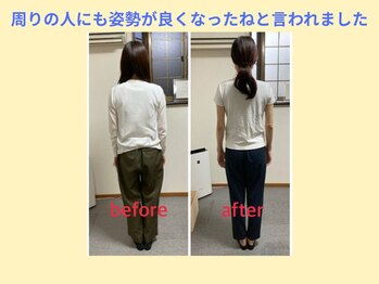 はしもと鍼灸整骨院/整体before→after