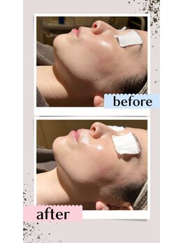 ファウンデーション(FOUNDATION)/