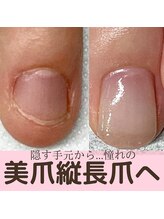 エルアンド(elle＆)/深爪から縦長爪へ変化