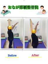 おなが浦添当山整体院/肩可動域改善！