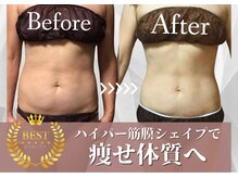 チャンティック(Cantik)の雰囲気（当店自慢のハイパー筋膜シェイプ♪男性メニューもご用意あり）