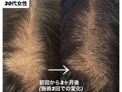 ヘッドサイエンス(HEADSCIENCE)の写真