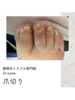 オツメ 静岡(O-tume)/爪切り