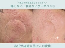 フォンビューティー(fon beauty)の雰囲気（リアボーテ・プロセルセラピーズでのオーダーメイド施術）