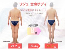 エステ ステーション 神戸三宮店の雰囲気(リジュ全身8回 47歳の方です!79.2kg→55.9kg【-23.3kg】)