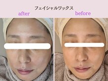 まつげや いちじくの雰囲気（フェイシャルワックス/角質除去、毛穴ケア、トーンアップ◎）
