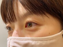 アール ヘッドスパ(R head spa)/【パリジェンヌ/まつげパーマ】