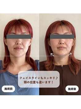 ウーマンビーヘルス(woman Be Health)/オーダーメイド美容鍼灸90分