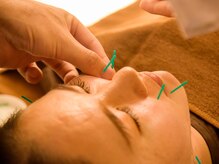 エクステンド鍼灸整体院(extend鍼灸整体院)/美容鍼