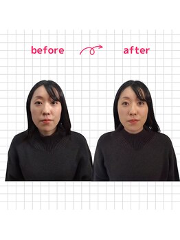 ナチュラルハリー(NaturalHarry)/当サロン自慢の経絡小顔施術!