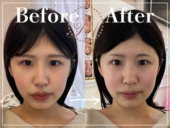 R-1ビューティーサロン 表参道/Before&After