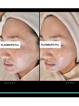 ワイケー(yk)/プラズマ１回