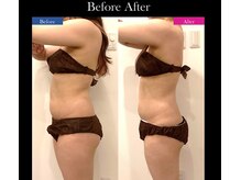 シアン(CYAN)/全身施術3回