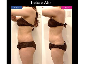 シアン(CYAN)/全身施術3回