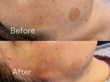 サロンララ(Salon Lala)の雰囲気（毎月定期的に通うことでお肌の変化を実感していただいています！）