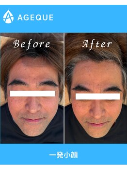アジーク 町田店(AGEQUE)/この変化、体験しませんか?