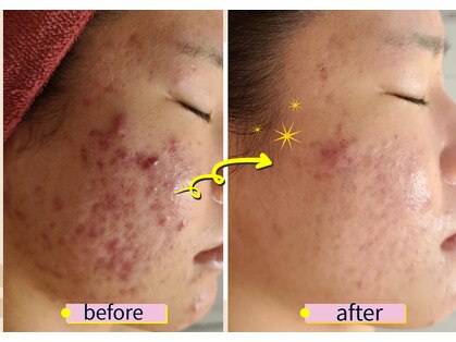 痩身 アンド バスト専門サロン プラナ 町田店(PRANA)の写真