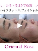 オリエンタルローザ 表参道(Oriental Rosa)/シミ・くすみ改善 1度で効果◎
