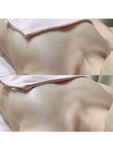 エヌエー(na)/光豊胸バストアップケア