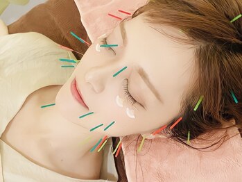 チキバンビューティーサロンの写真/国家資格者による本格施術◎美肌&リフトアップに効果抜群◇《美容鍼スタンダード&リンパマッサージ¥6,600》