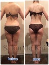 サロンドカイ(Salon de Kai)/ハイブリッドダイエット初回