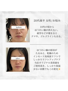 メディカルエステ 東銀座店/30代前半 女性