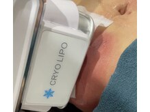 アグライア(Aglaea)/脂肪冷却／術後