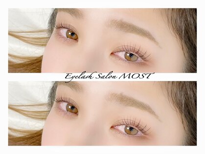 モスト(MOST)の写真