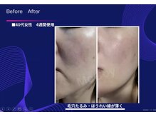 リリーローズ(LilyRose)の雰囲気（【ほうれい線が消える！】たるみ改善化粧品取り扱い☆）
