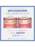 【8月限定】初めての方◎ハイパワーホワイトニング30分(15分×2回照射)￥2970