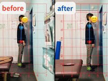 オンリー整体院(ONLY整体院)/befre aftter【桂　整体】