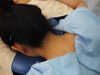 ケイ鍼灸院 in ヒガムコ(kei鍼灸院)の写真/首や肩のこり、慢性的な疲労・頭痛・自立神経の乱れ等にオススメ!鍼灸施術で筋肉の深部までアプローチ♪