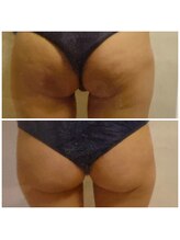 ダリア(DALIA)/お尻の形もエンダモロジー♪