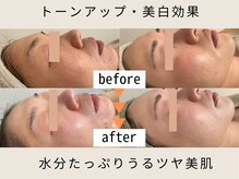 ナヴィータ アオバダイ(Navita AOBADAI)の雰囲気（40代以上のくすみがちなお肌もやく2ヶ月でここまでトーンアップ!）