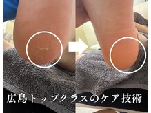 ラナ(LANA)の雰囲気（乾燥・ガサつき・硬い角質を整え、触れたくなる柔らかな足元へ◎）